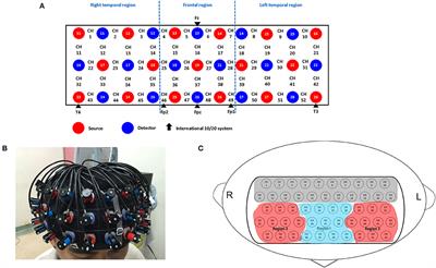 Deep Neural Network to Differentiate Brain Activity Between Patients With First-Episode Schizophrenia and Healthy Individuals: A Multi-Channel Near Infrared Spectroscopy Study